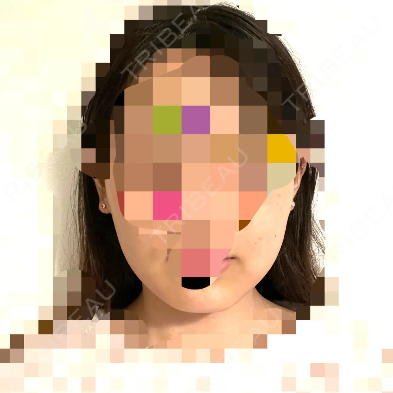 施術前の写真