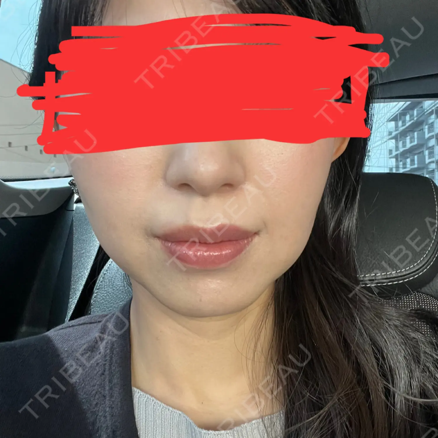 施術前の写真