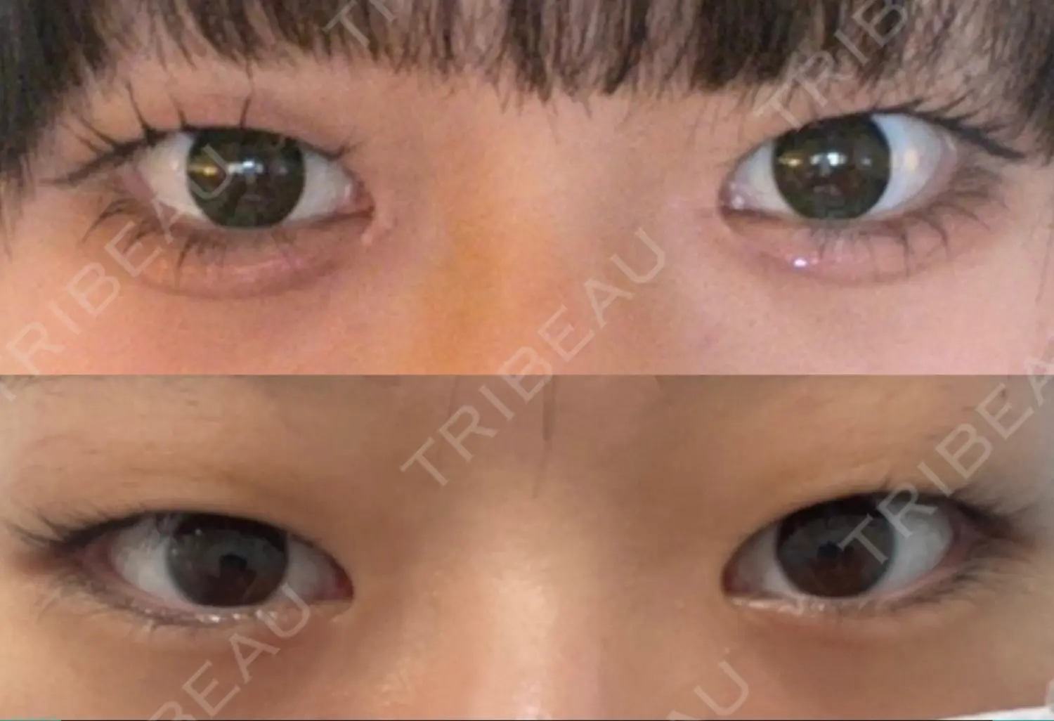 施術前の写真