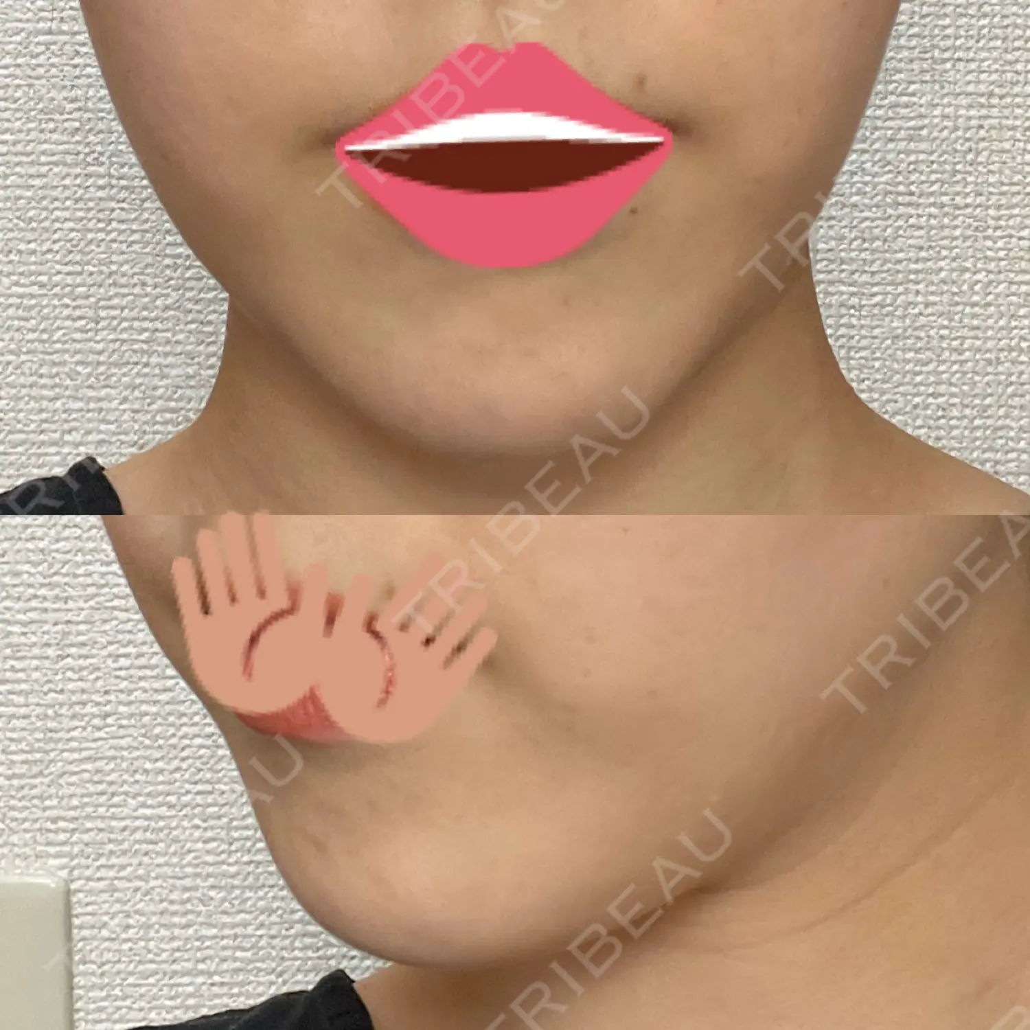 施術前の写真