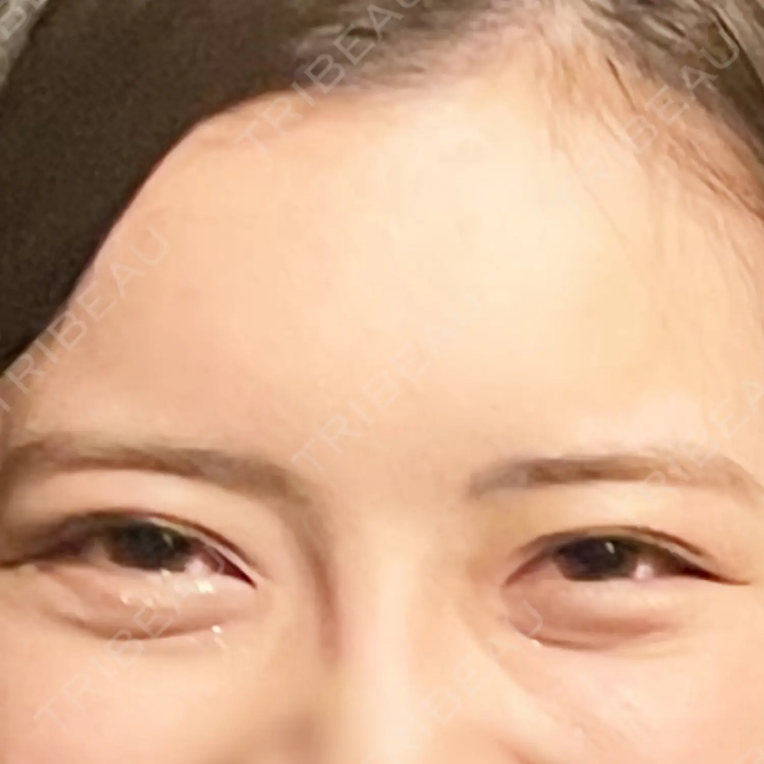 施術前の写真
