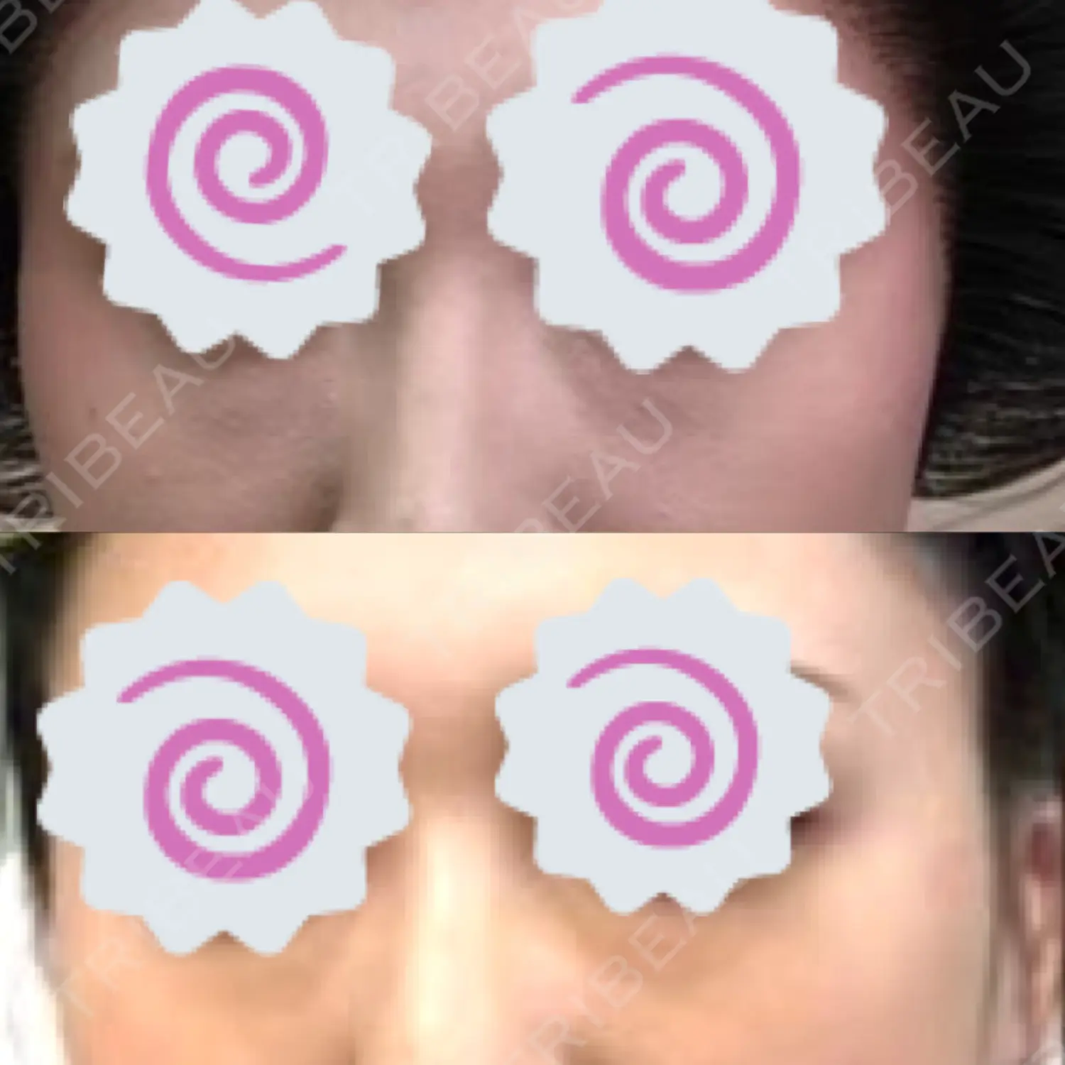 施術前の写真