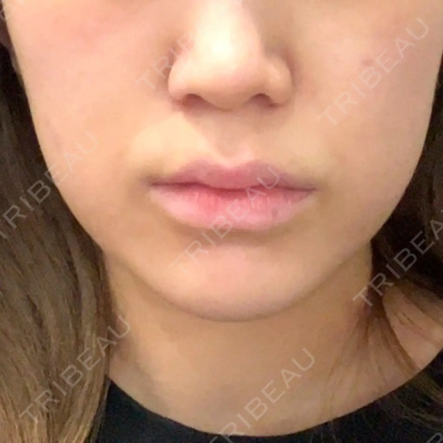 施術前の写真
