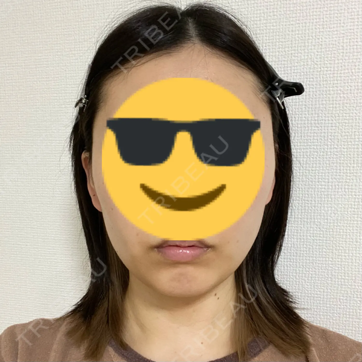 施術前の写真