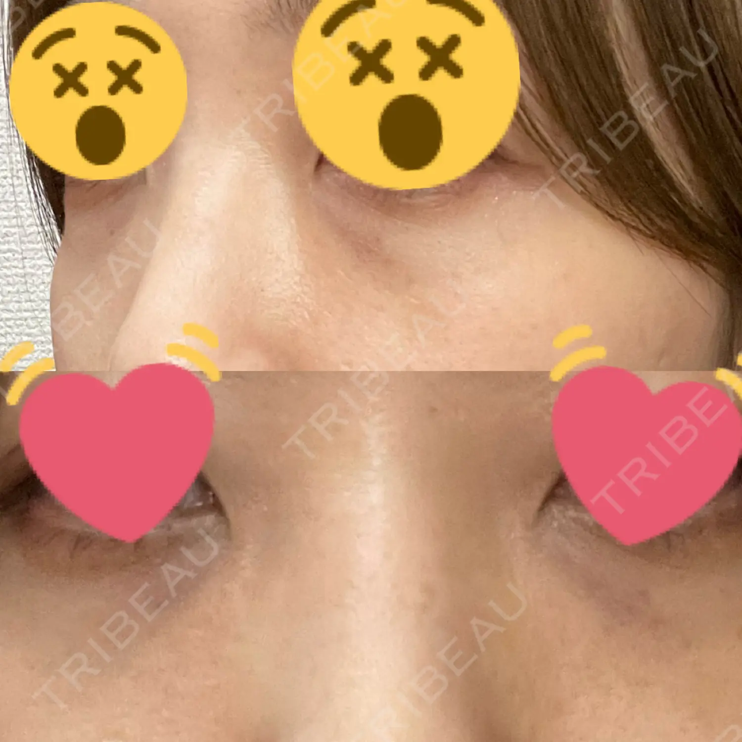 施術前の写真