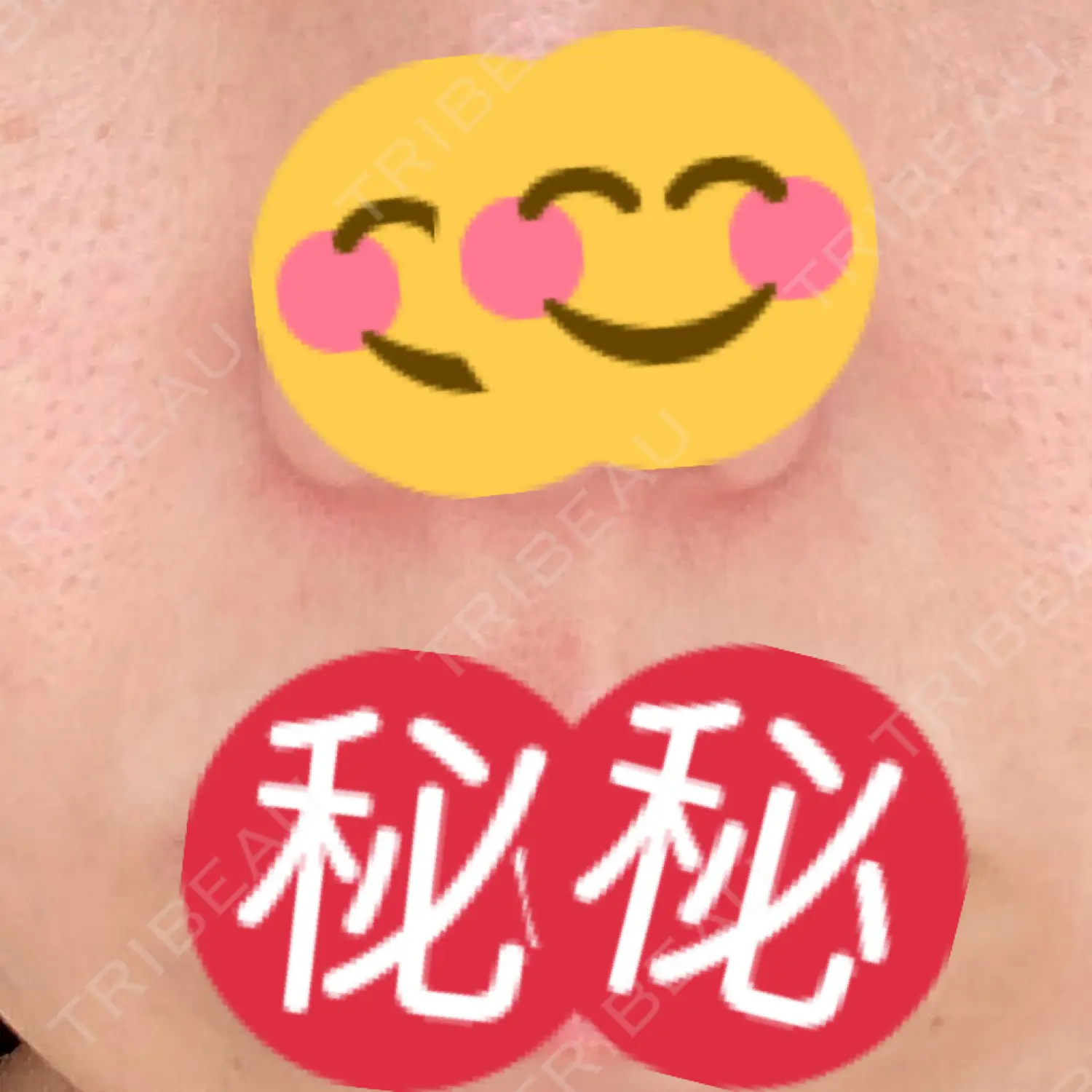 施術前の写真