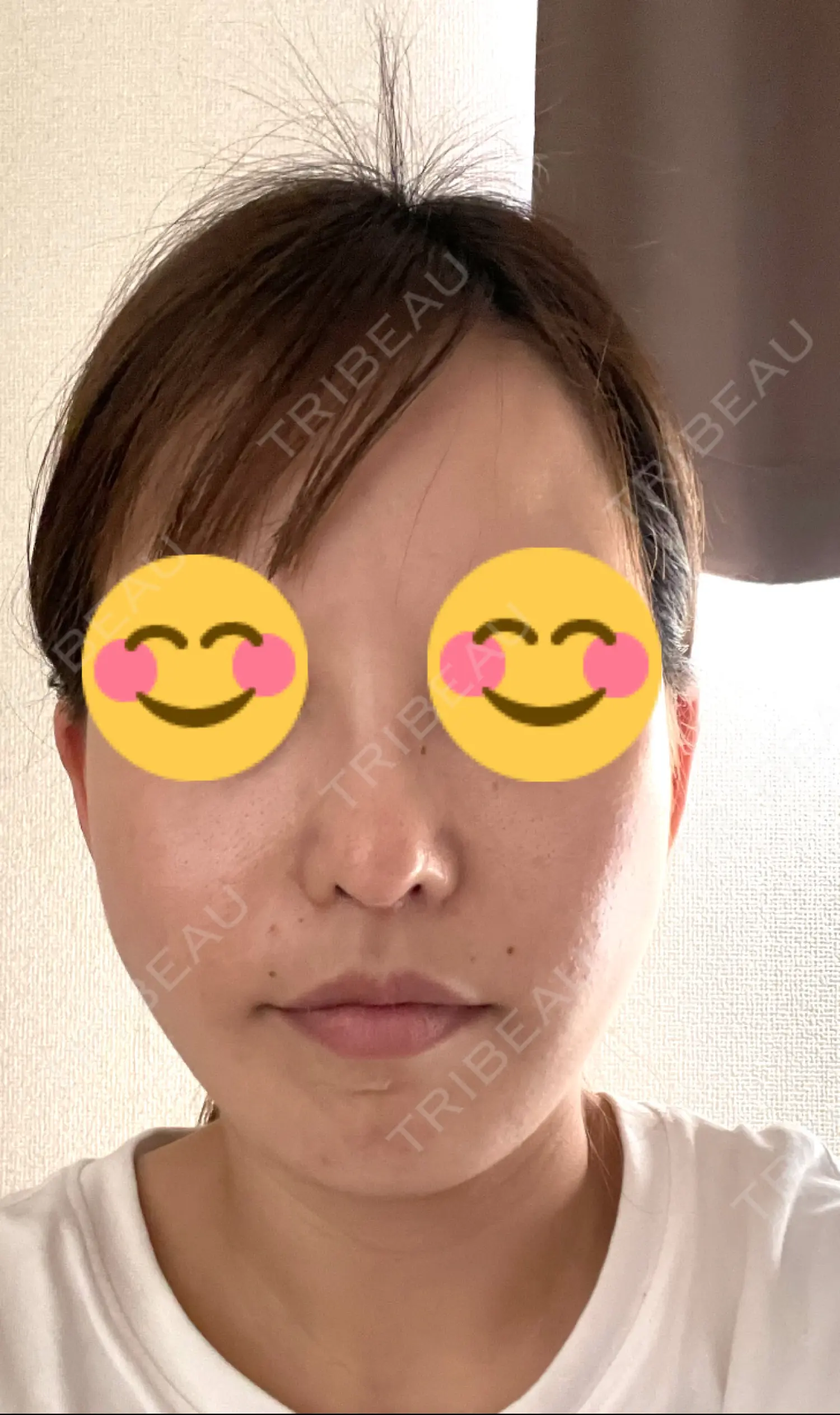 施術前の写真