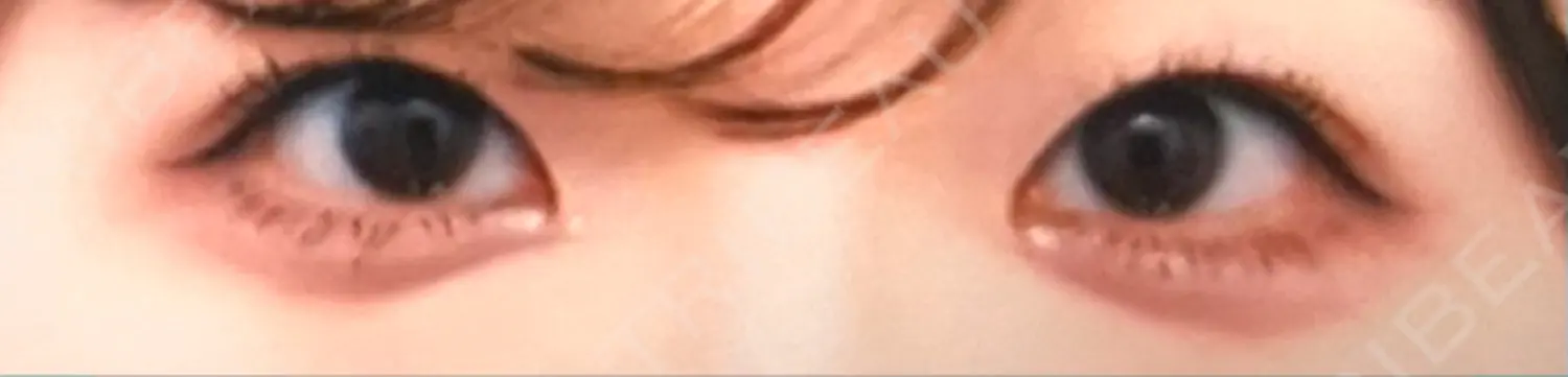 施術前の写真