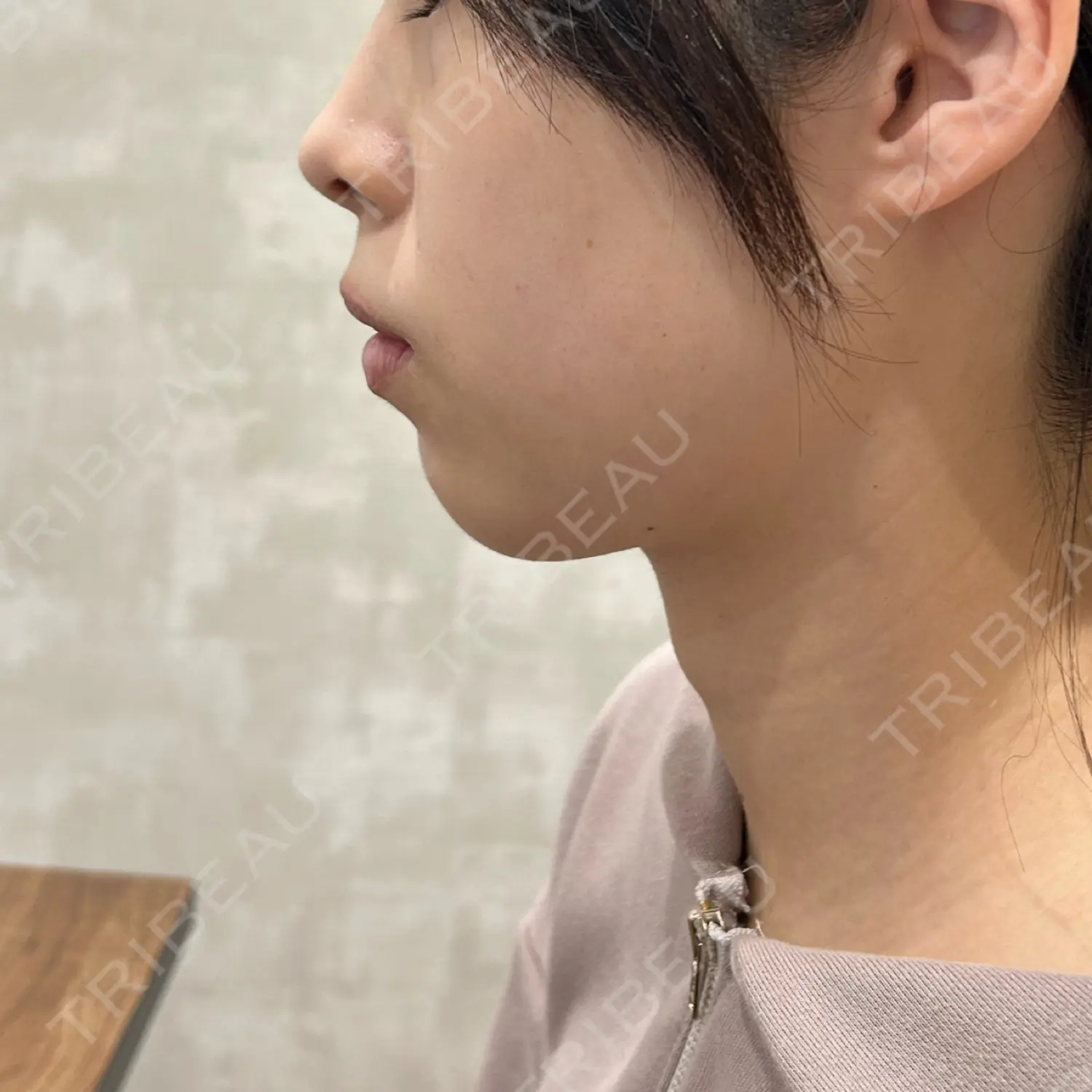 施術前の写真