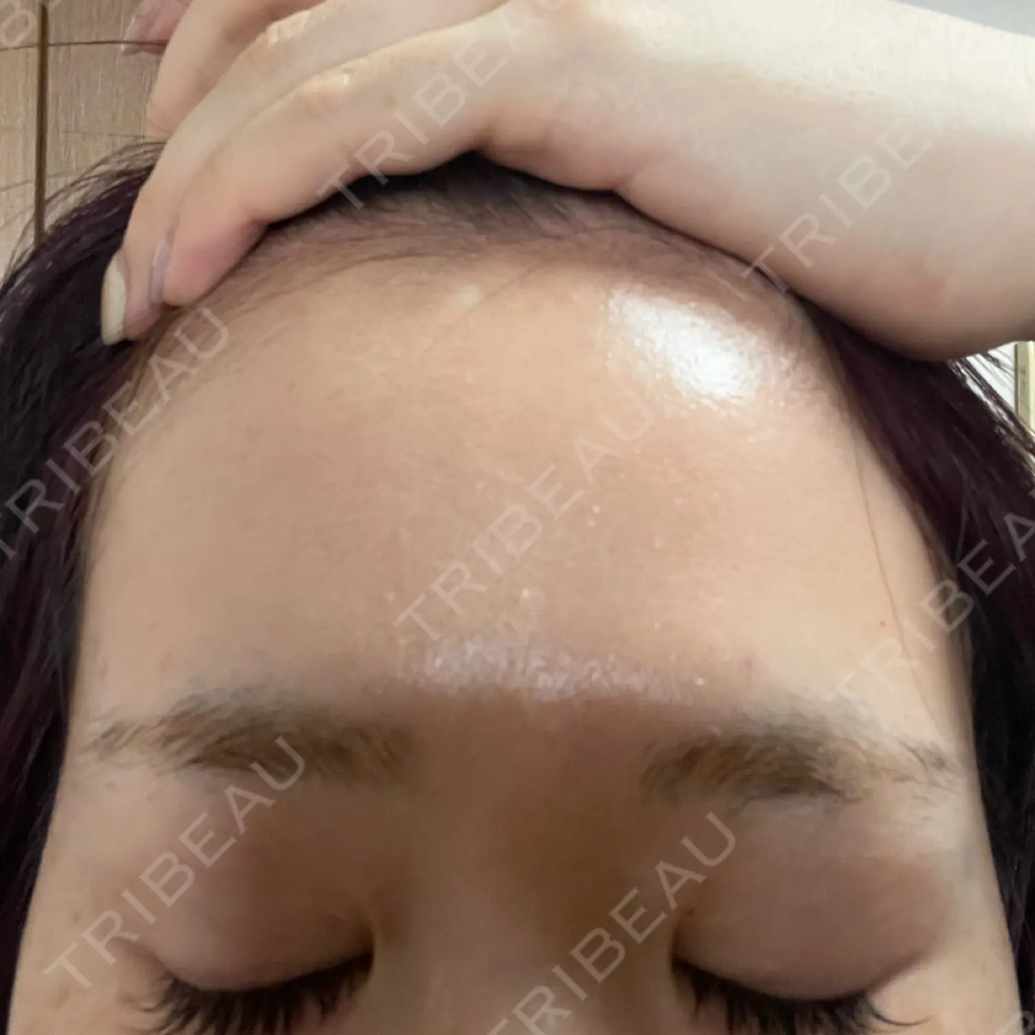 施術前の写真