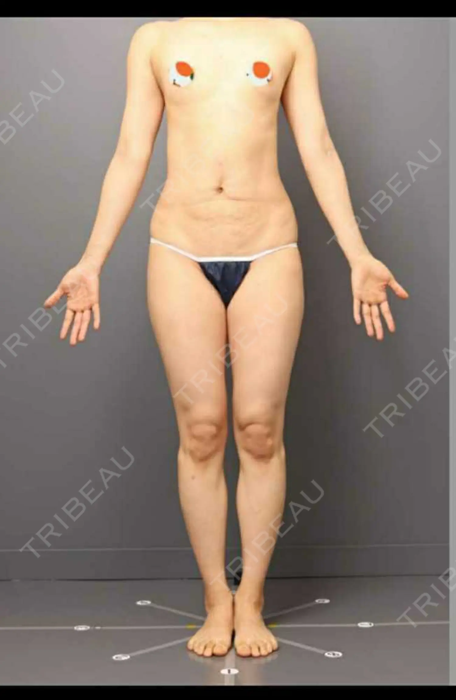 施術前の写真