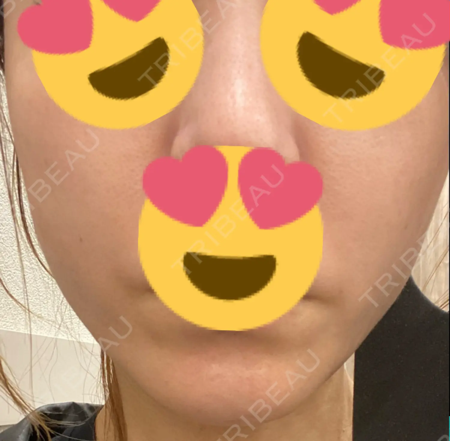 施術前の写真