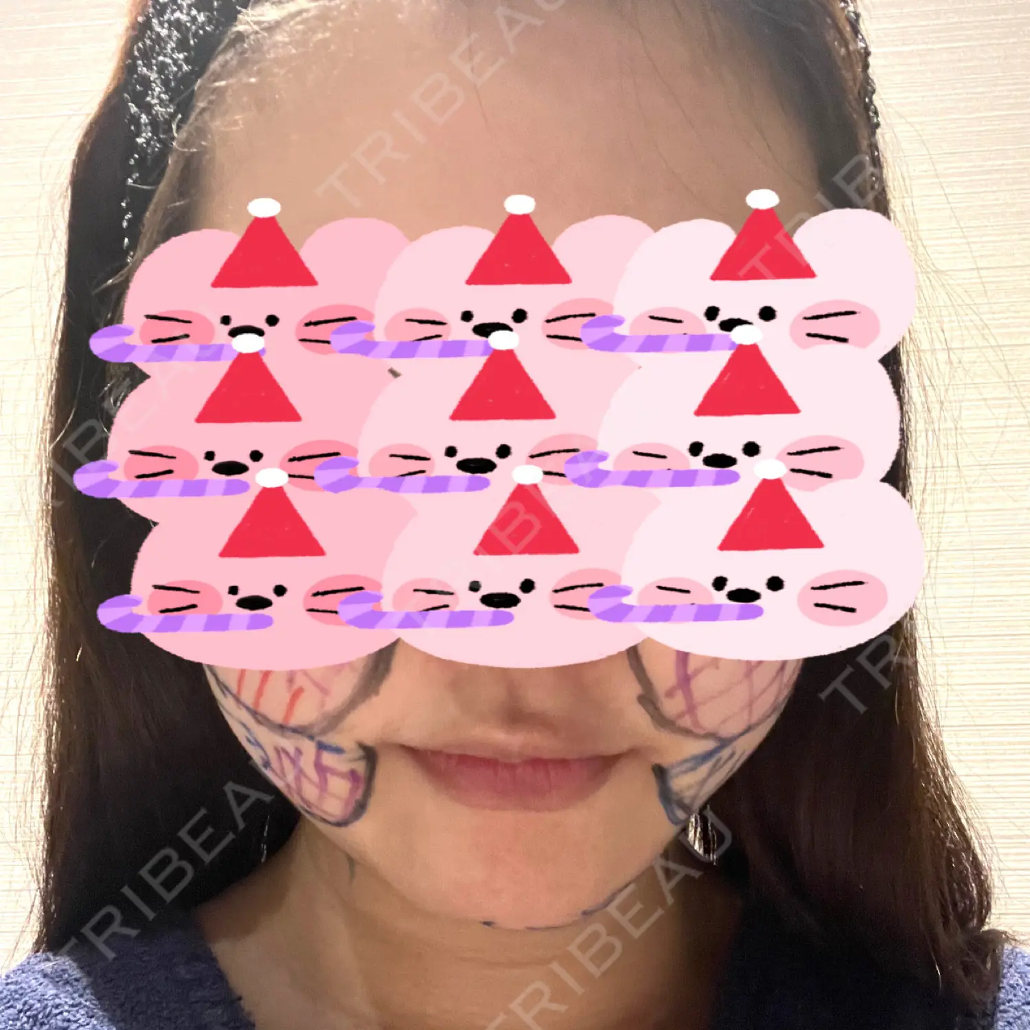 施術前の写真