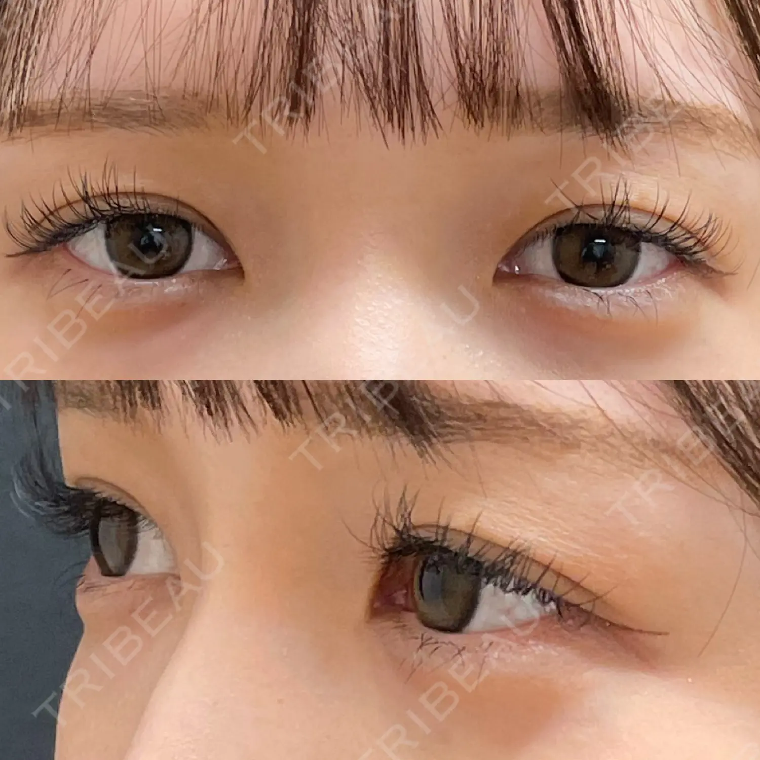 施術前の写真