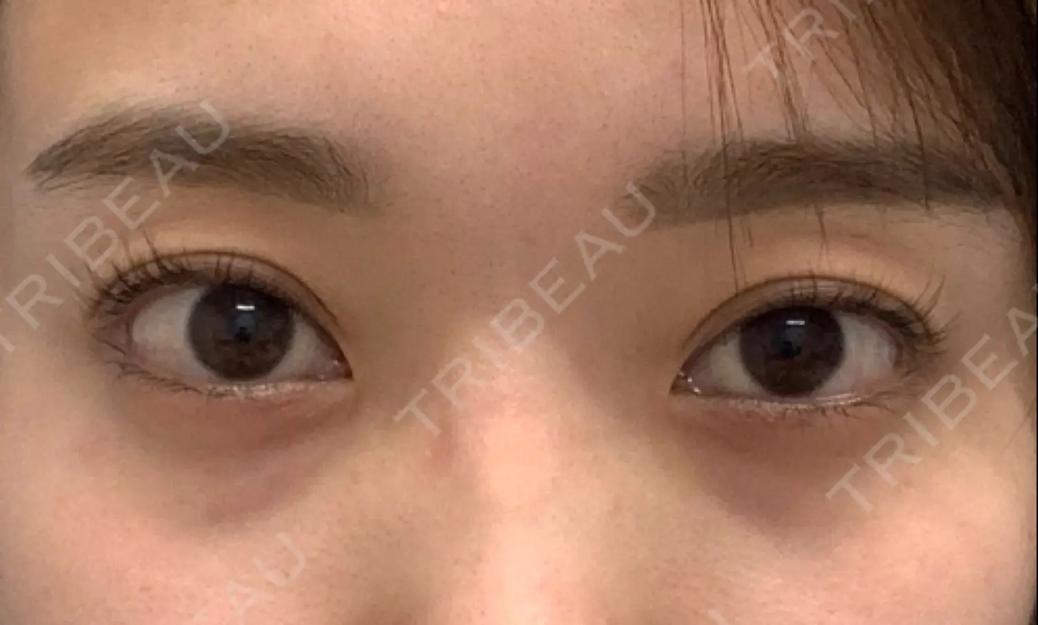 施術前の写真