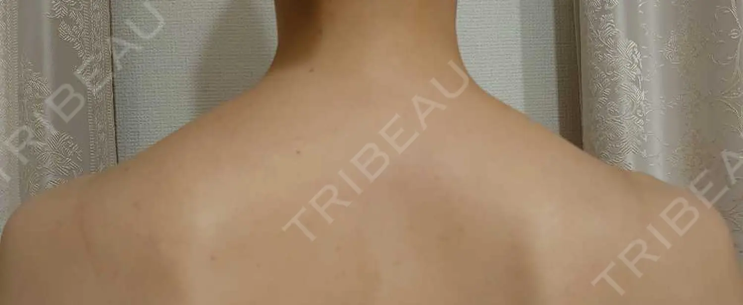 施術前の写真