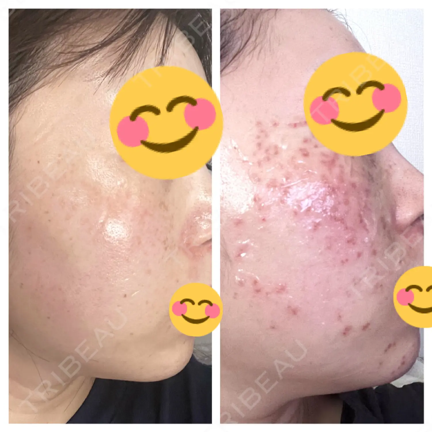 施術前の写真