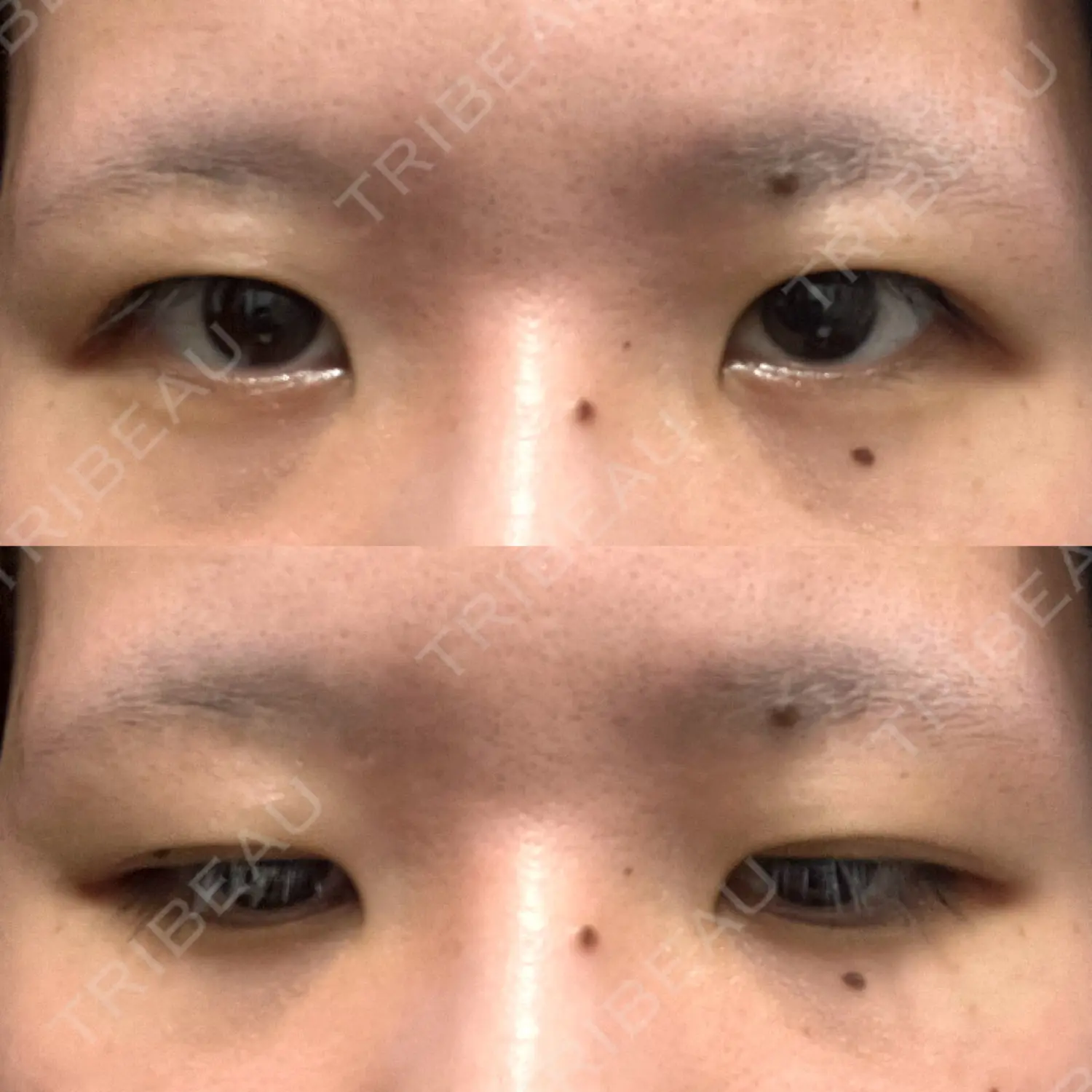 施術前の写真