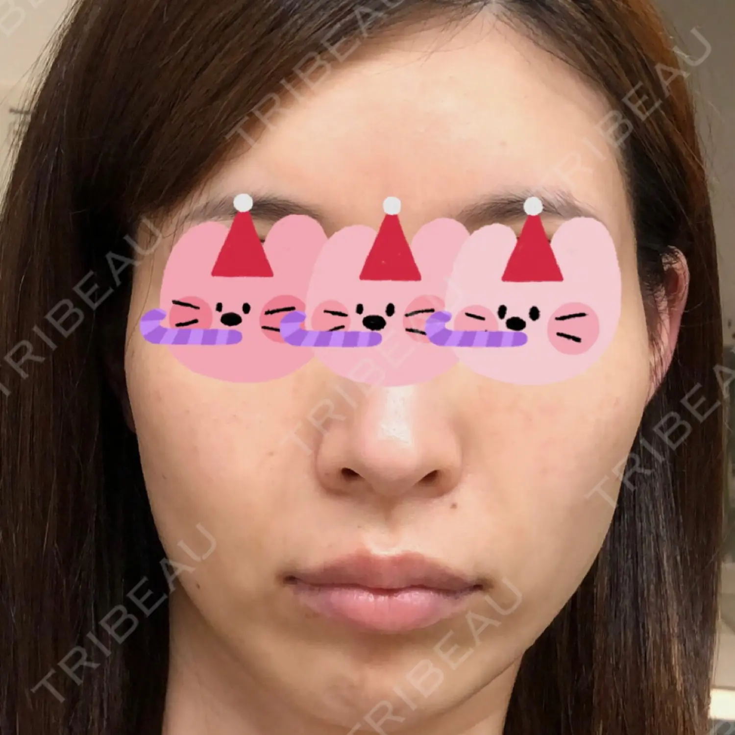 施術前の写真