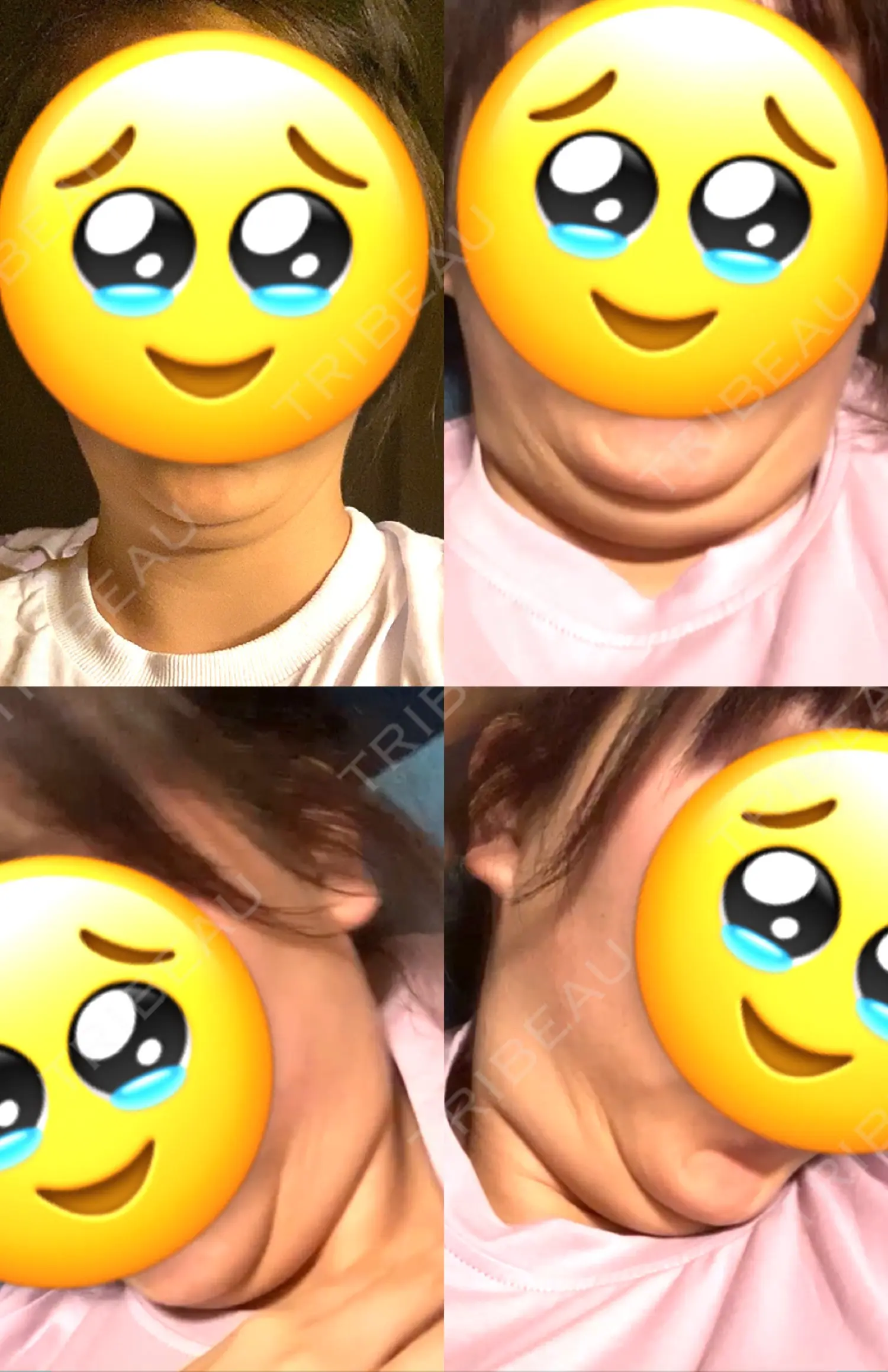 施術前の写真