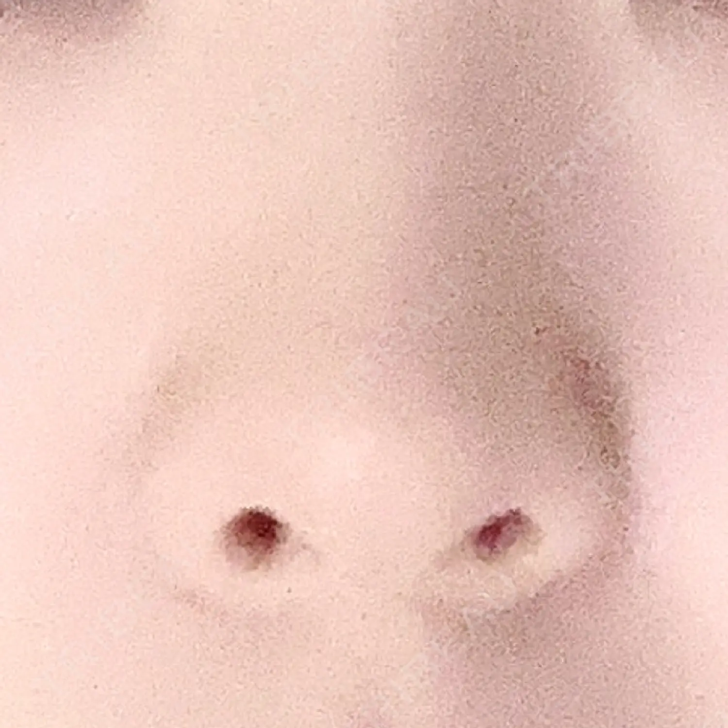 施術前の写真