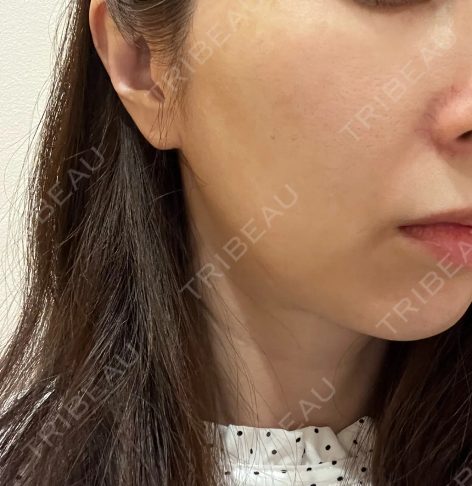 施術前の写真