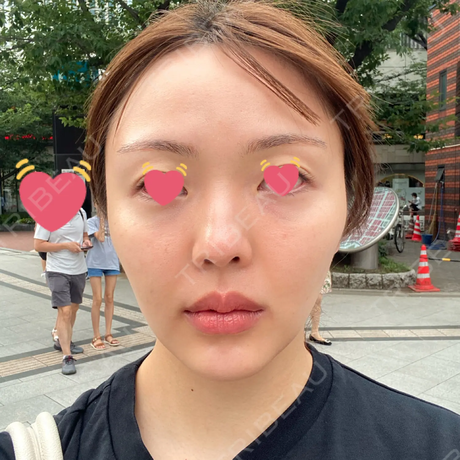 施術前の写真