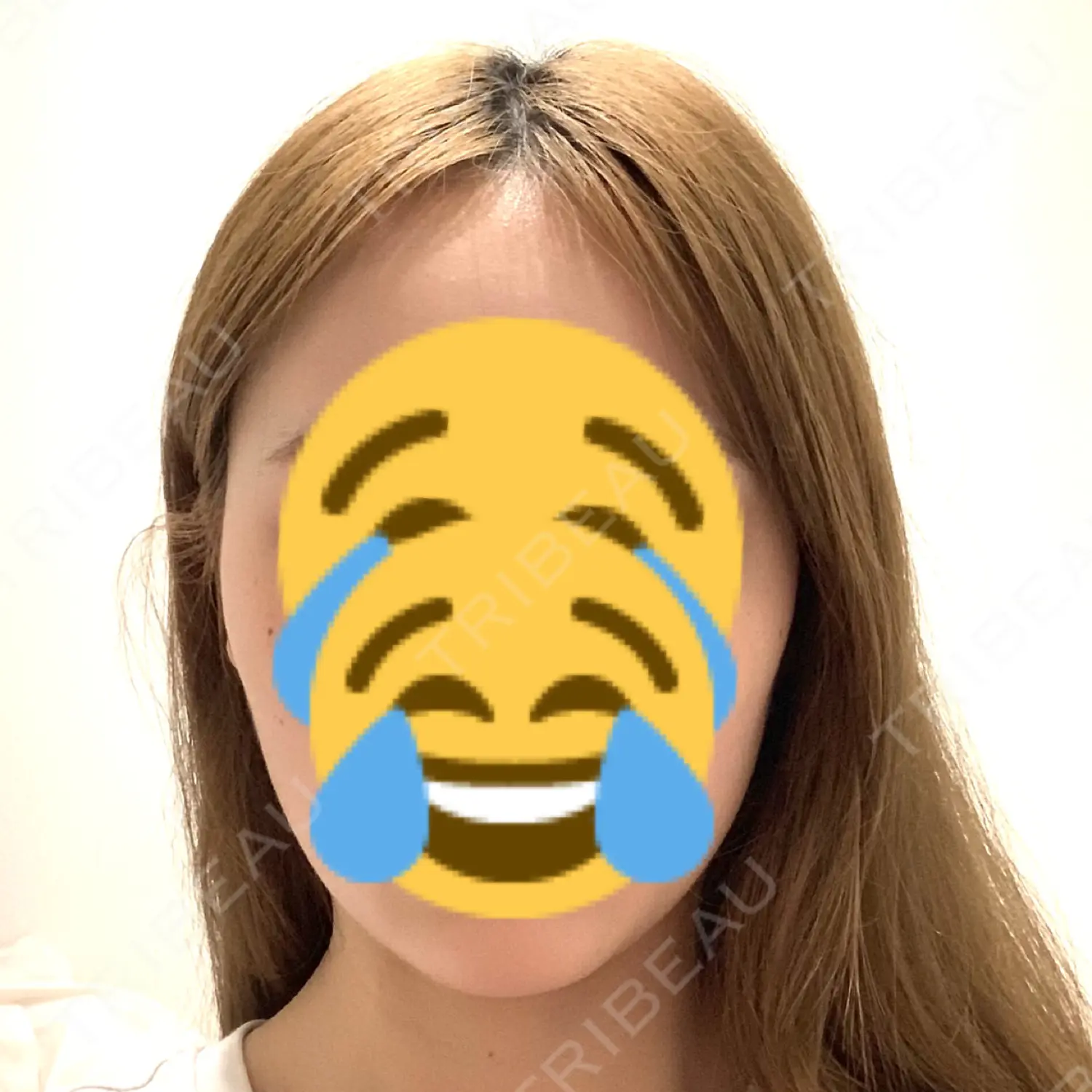 施術前の写真