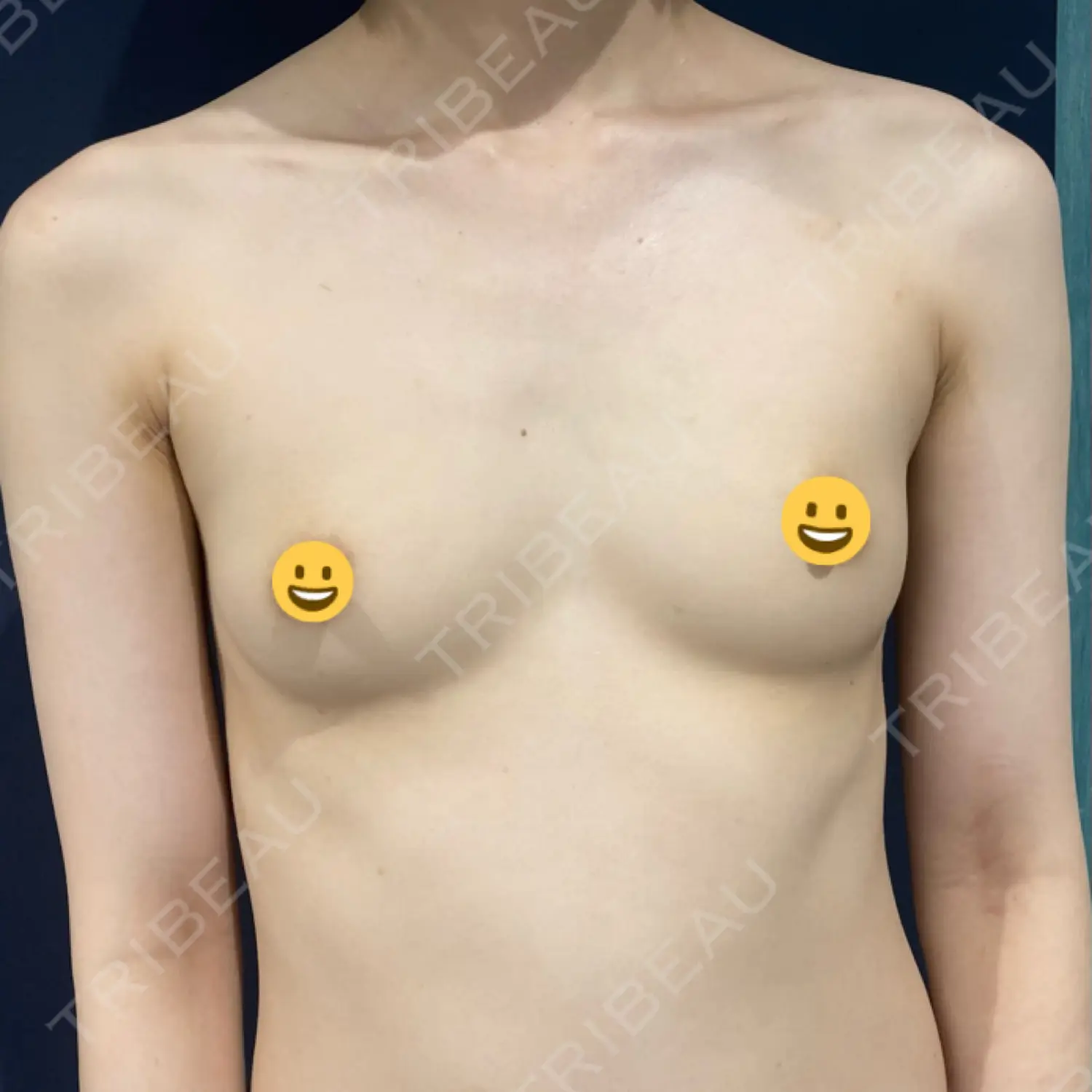 施術前の写真