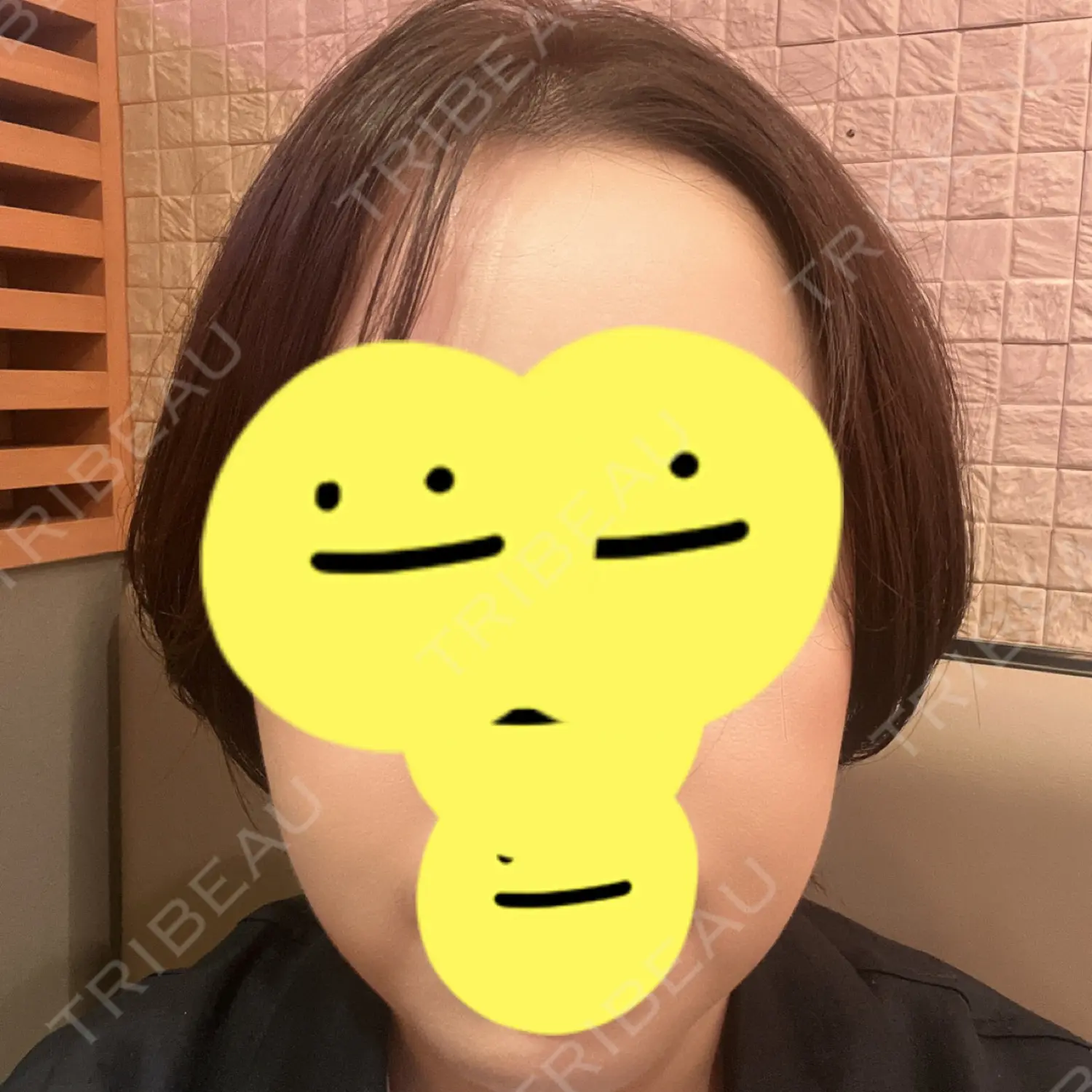 施術前の写真