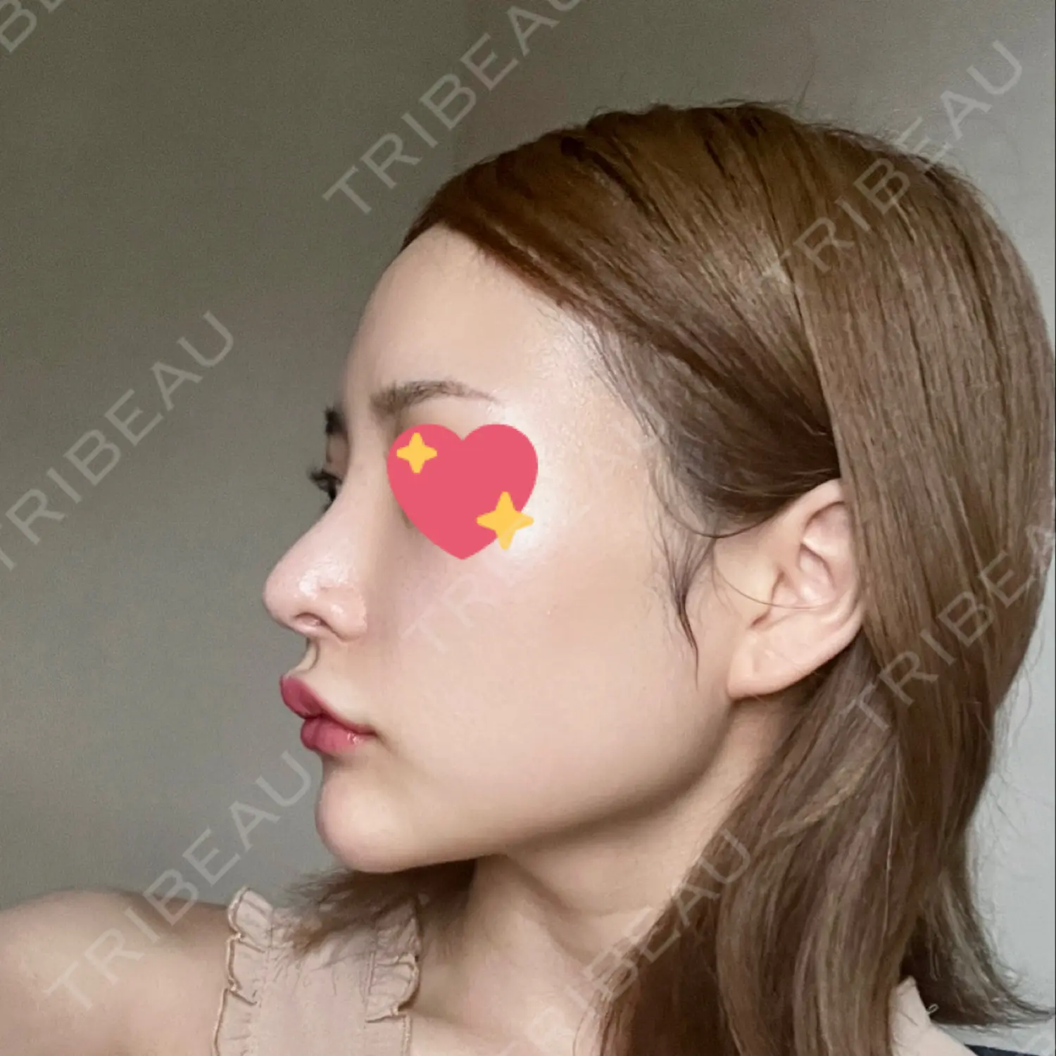 施術前の写真