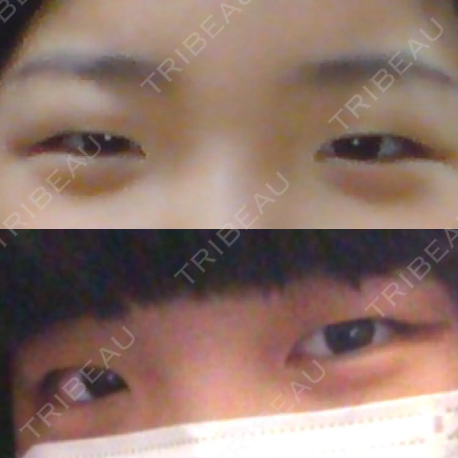 施術前の写真