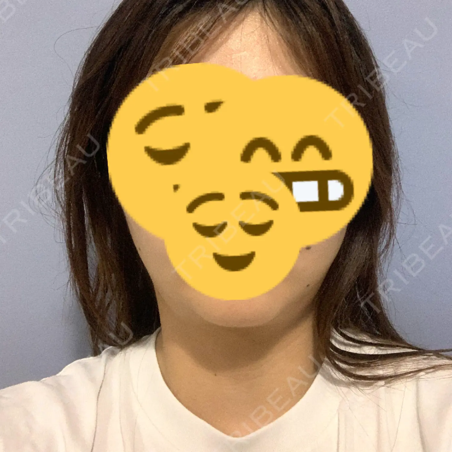 施術前の写真