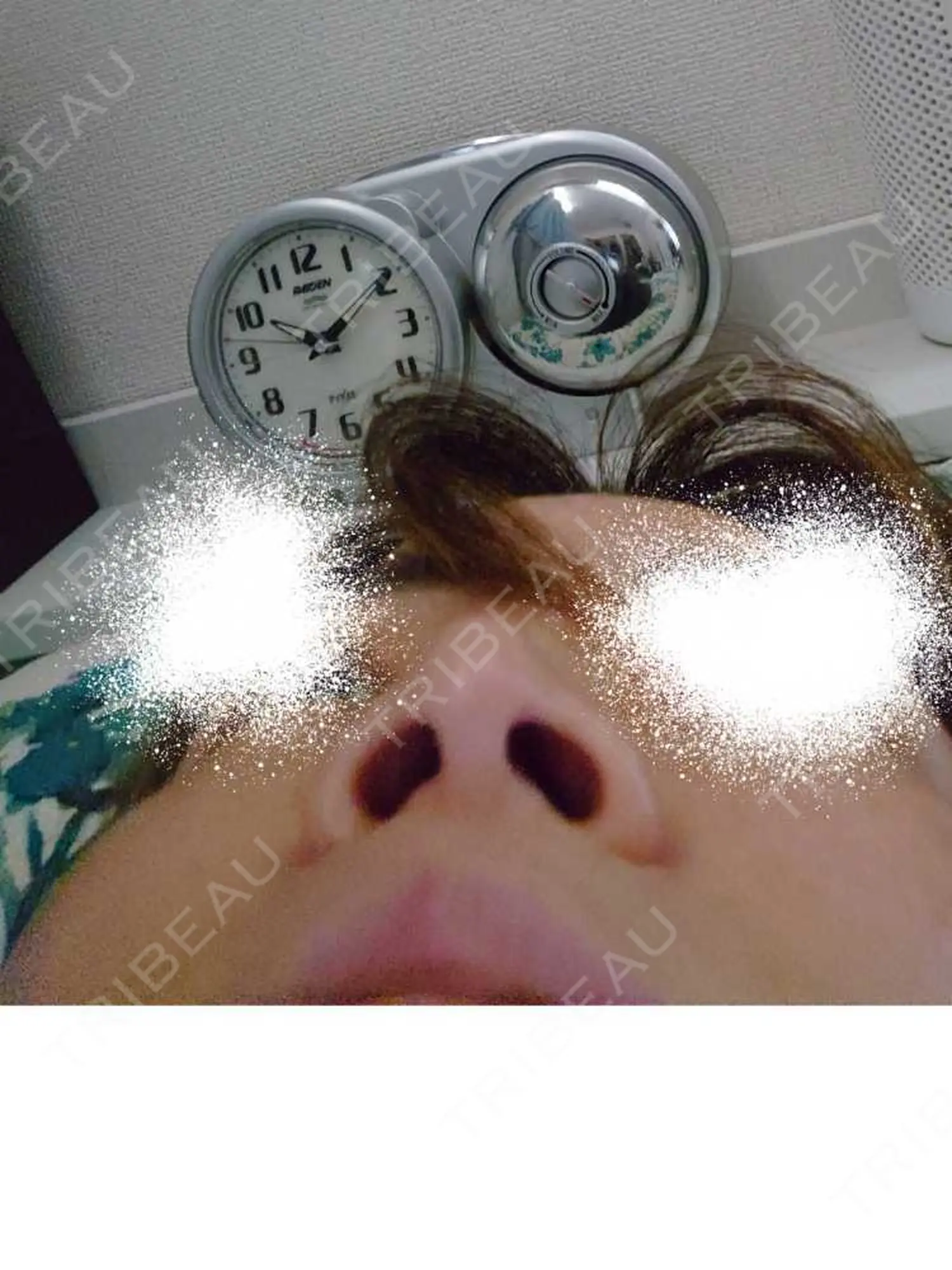 施術前の写真