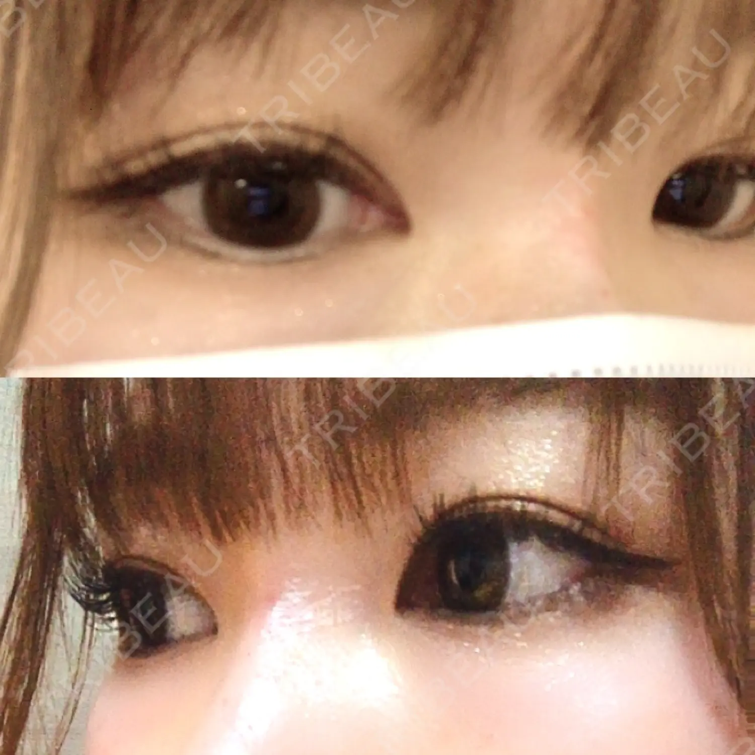 施術前の写真