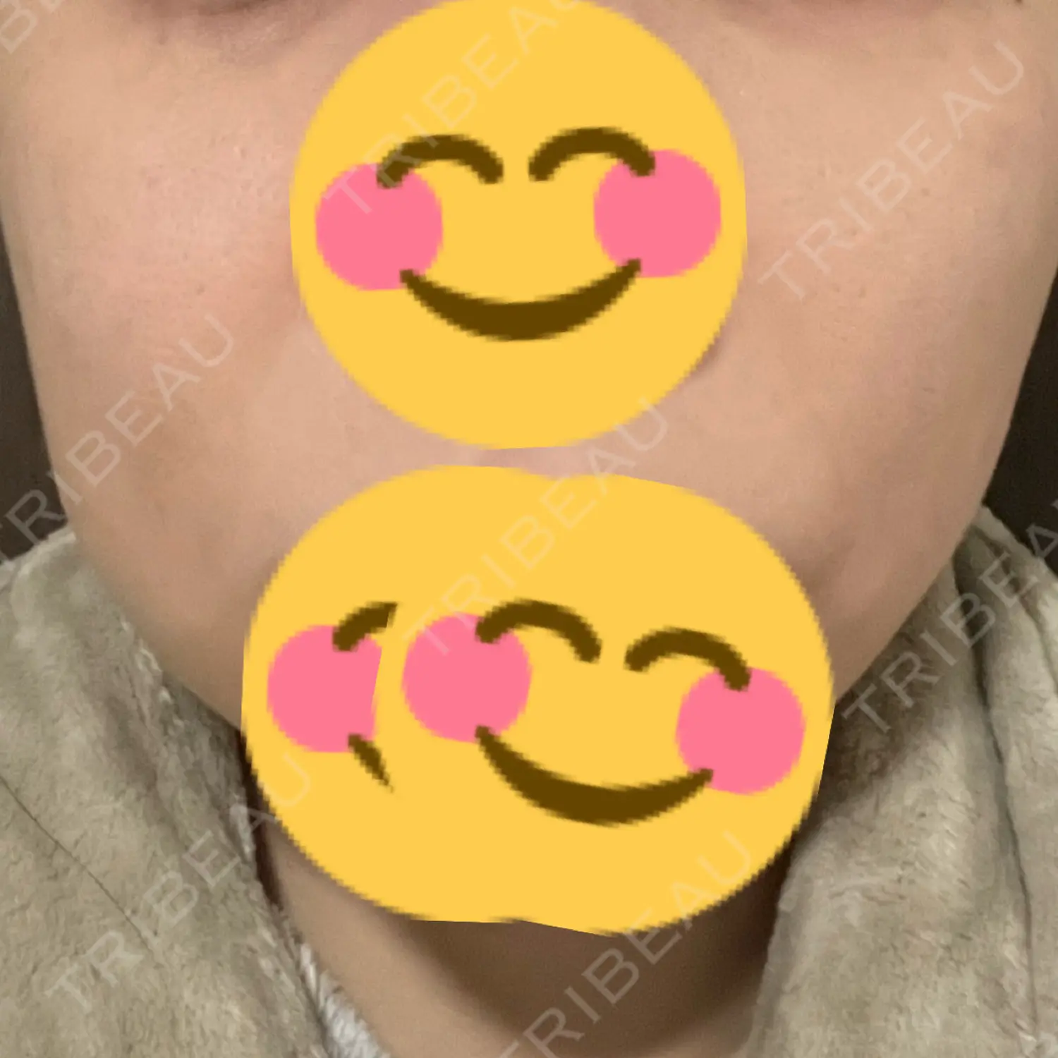 施術前の写真
