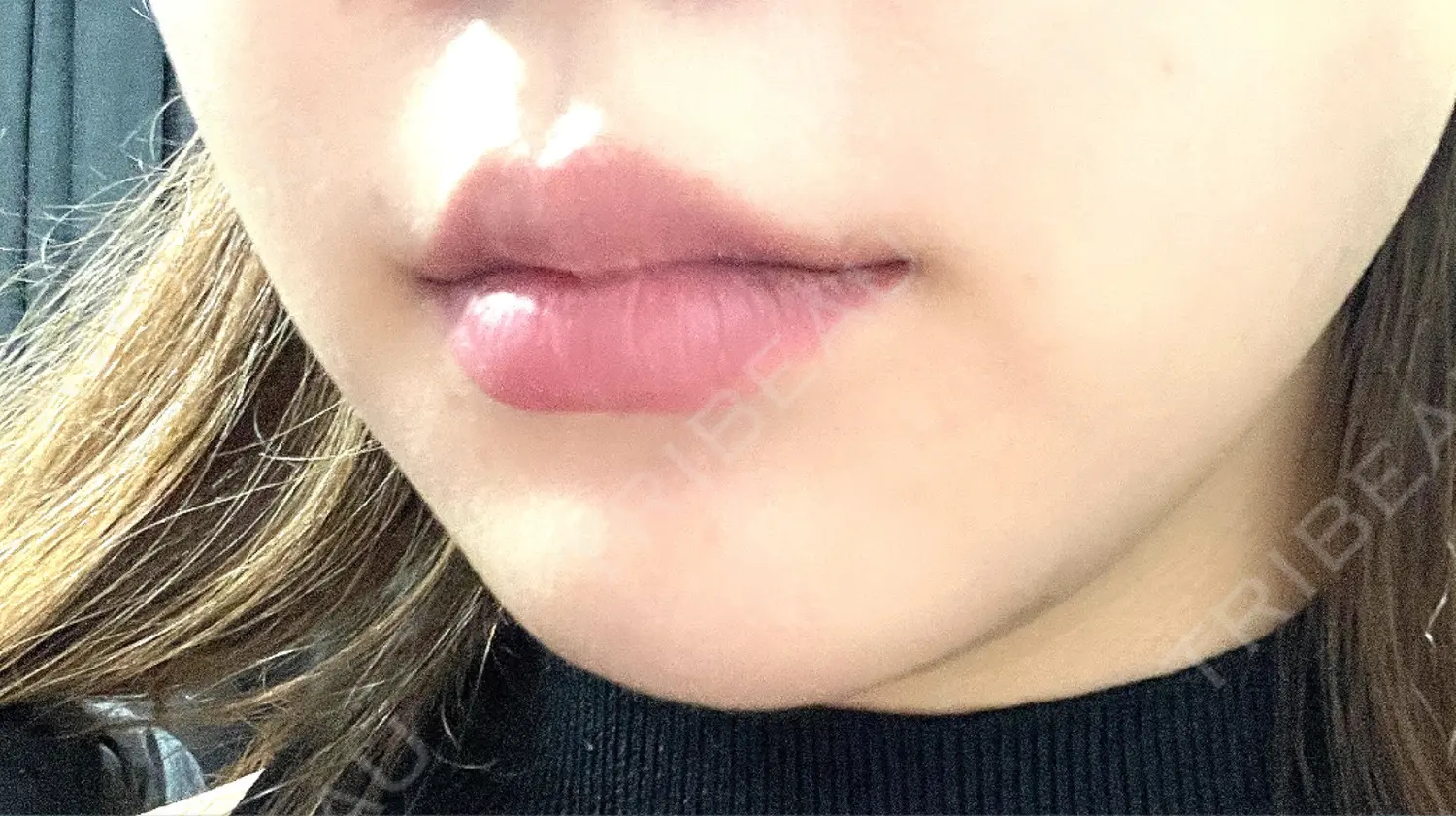 施術前の写真