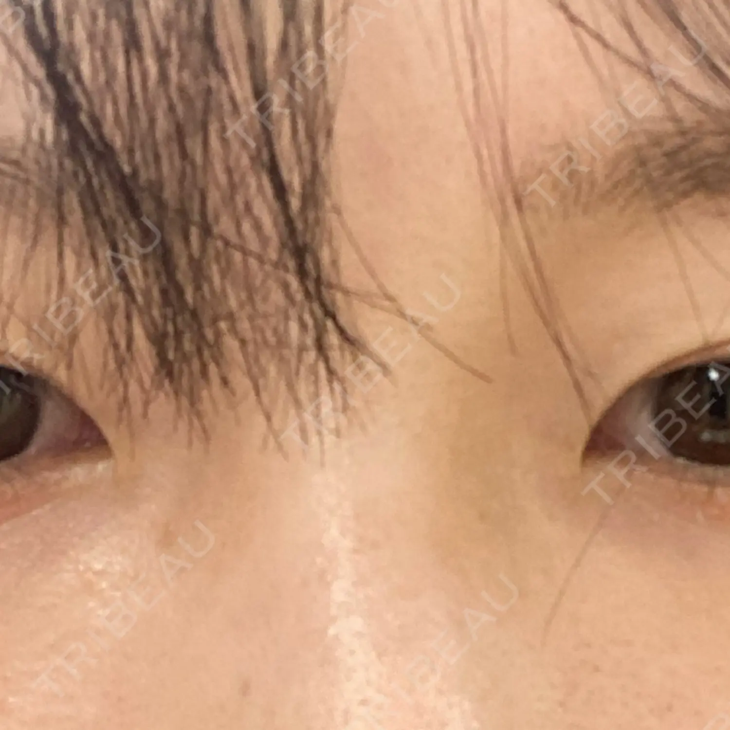 施術前の写真
