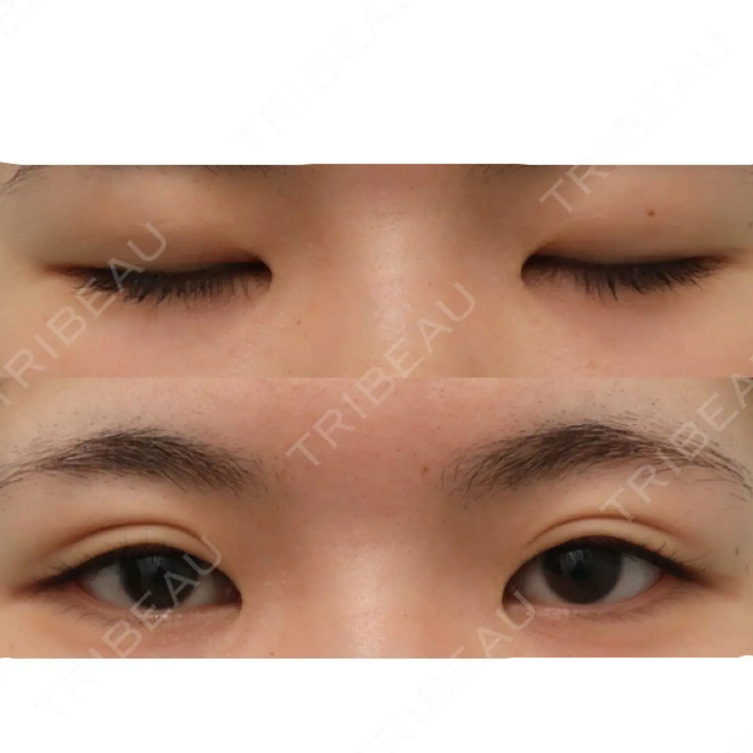 施術前の写真