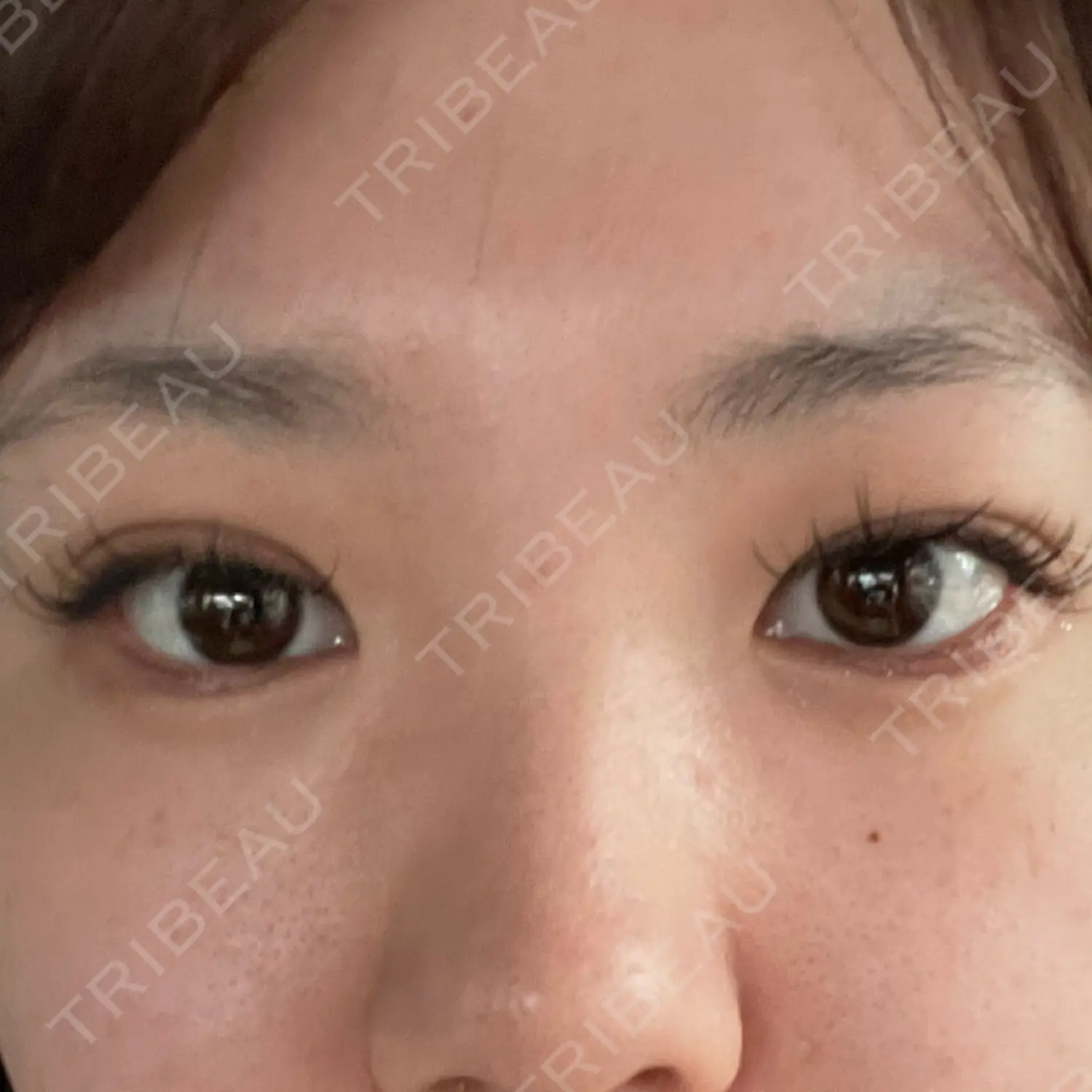 施術前の写真