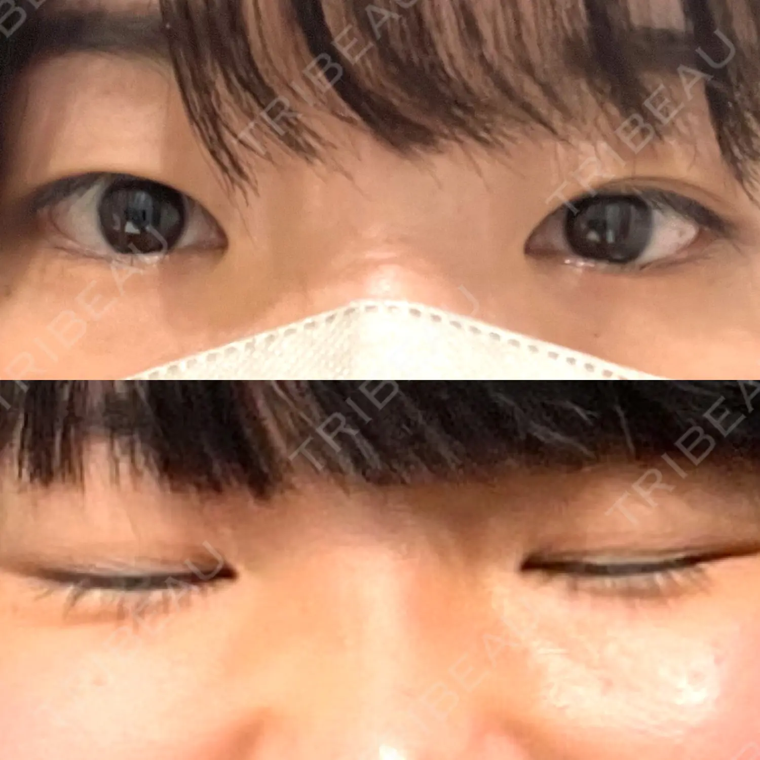施術前の写真