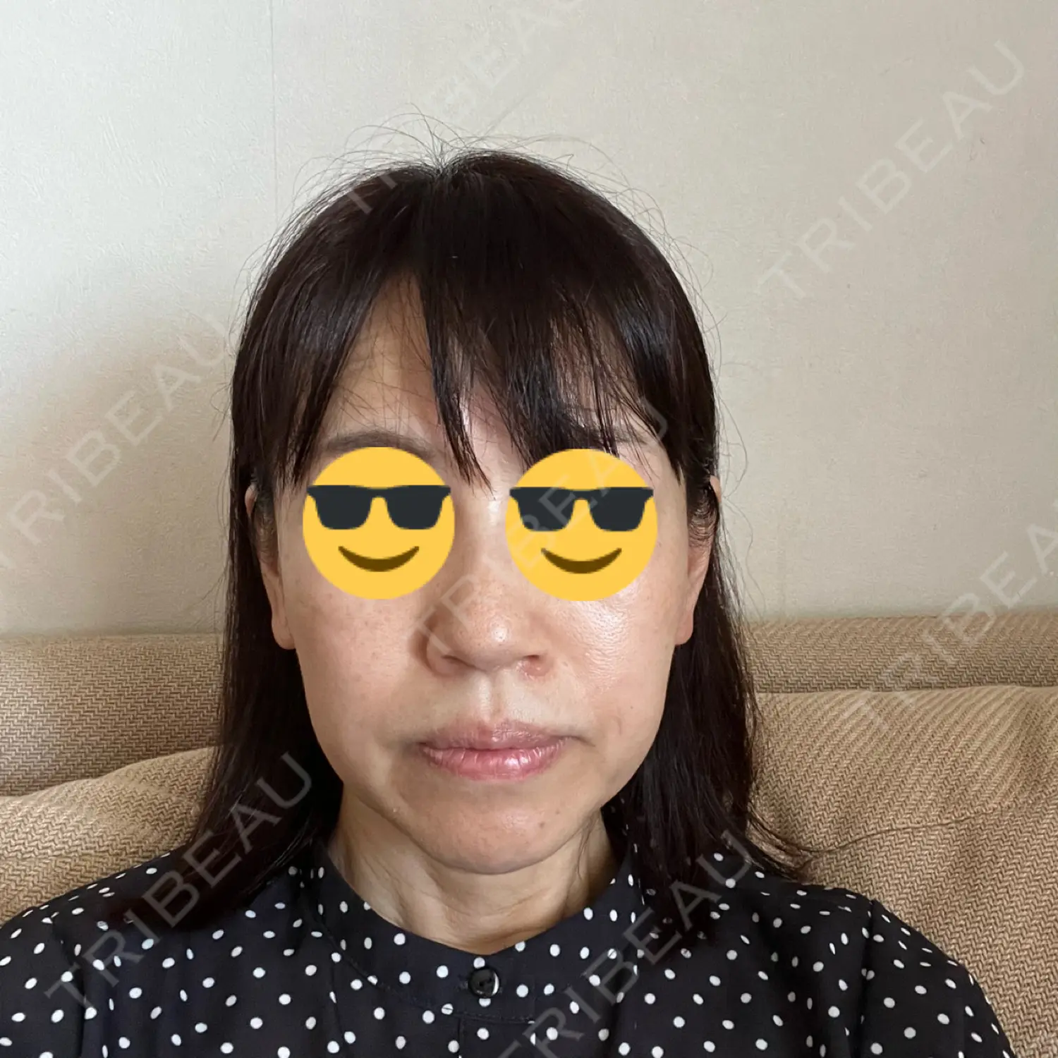 施術前の写真