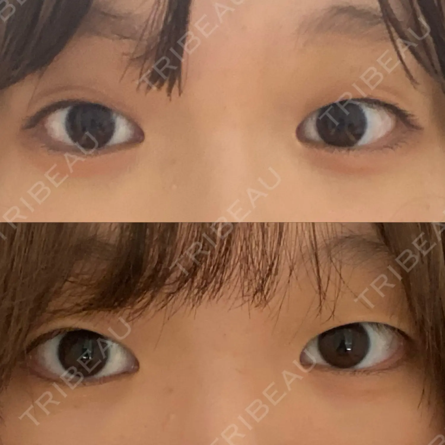 施術前の写真