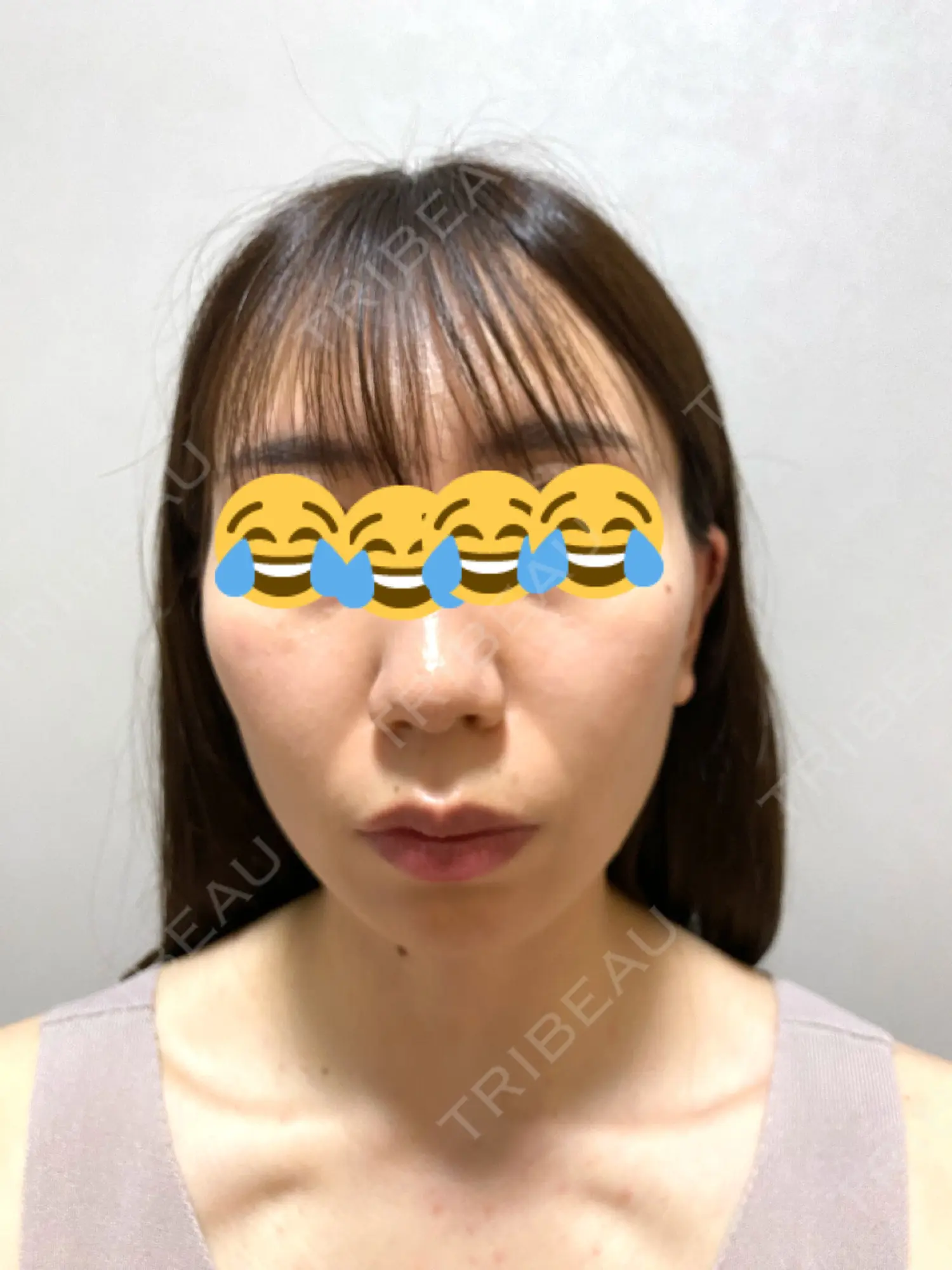 施術前の写真