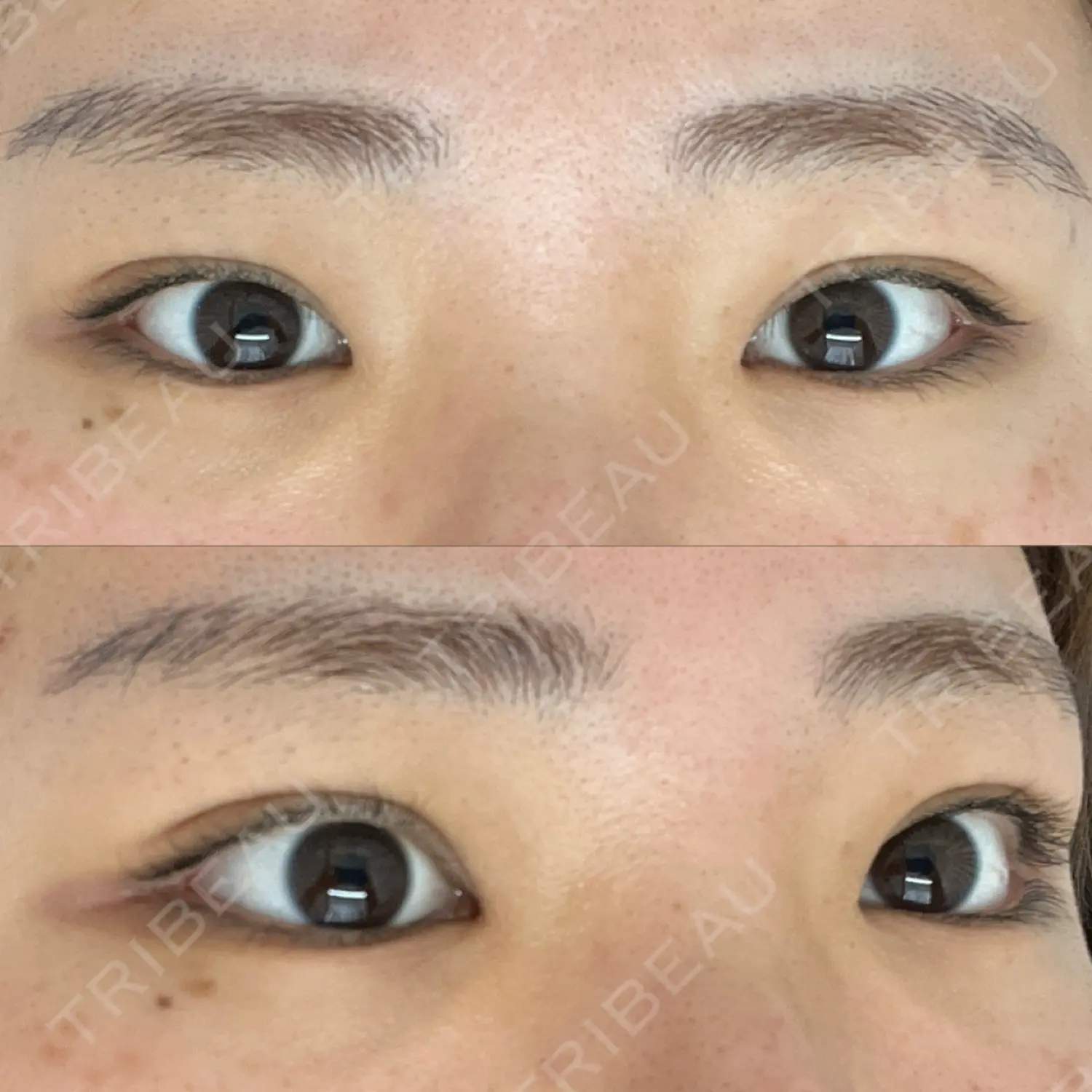 施術前の写真
