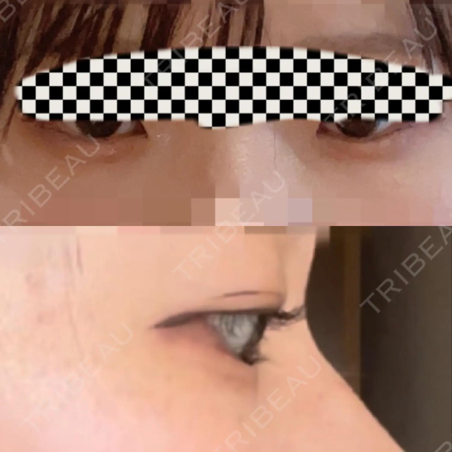 施術前の写真