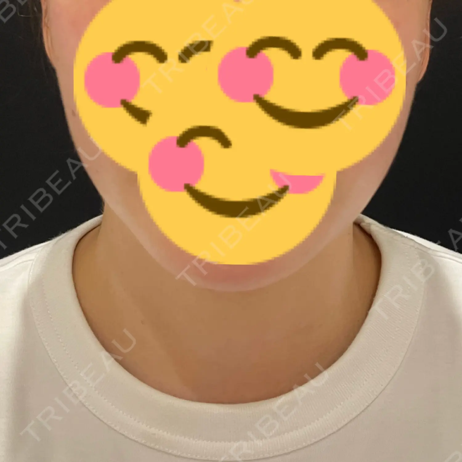 施術前の写真