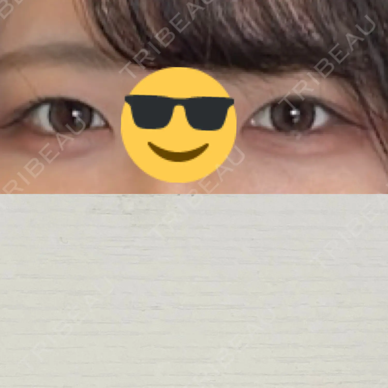 施術前の写真