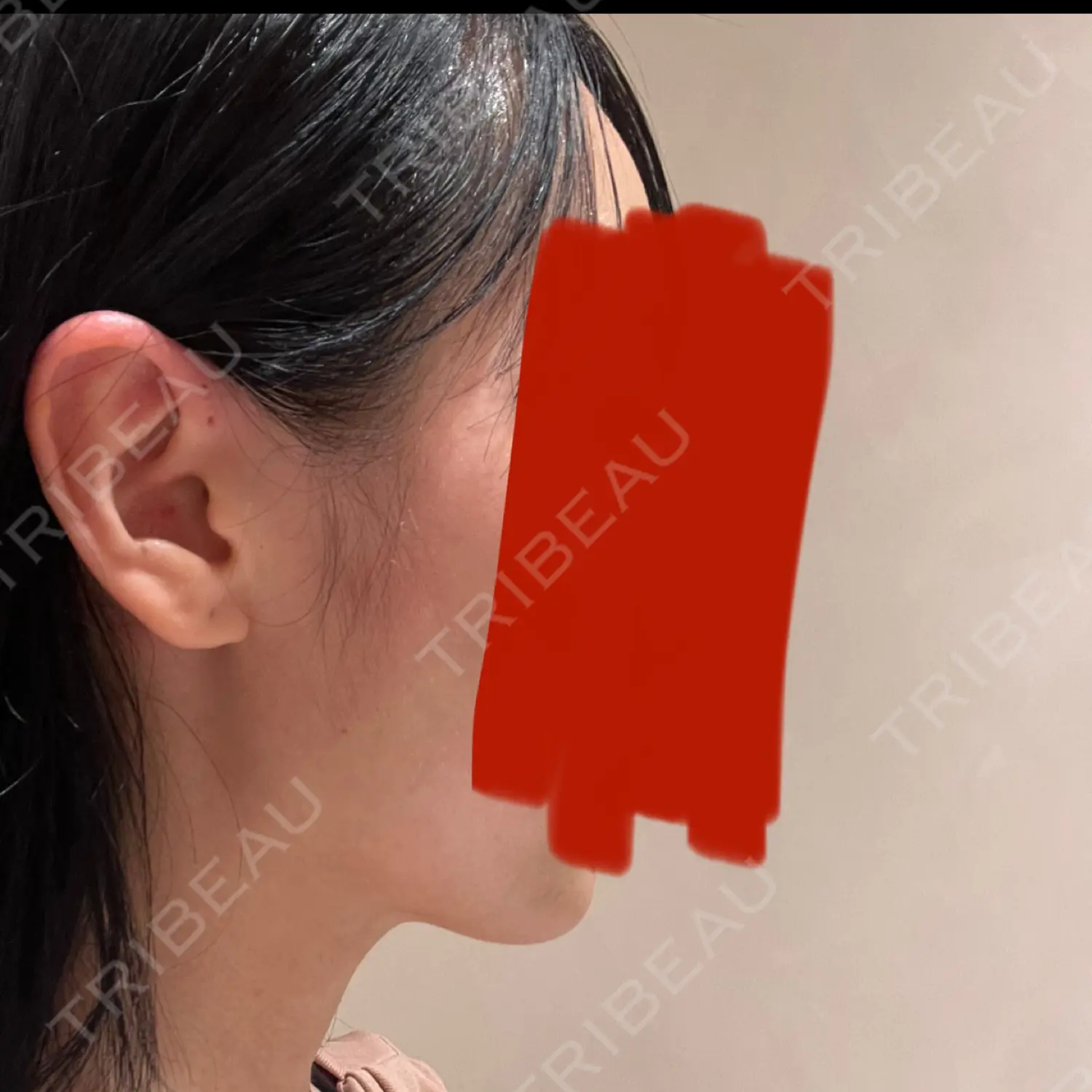 施術前の写真