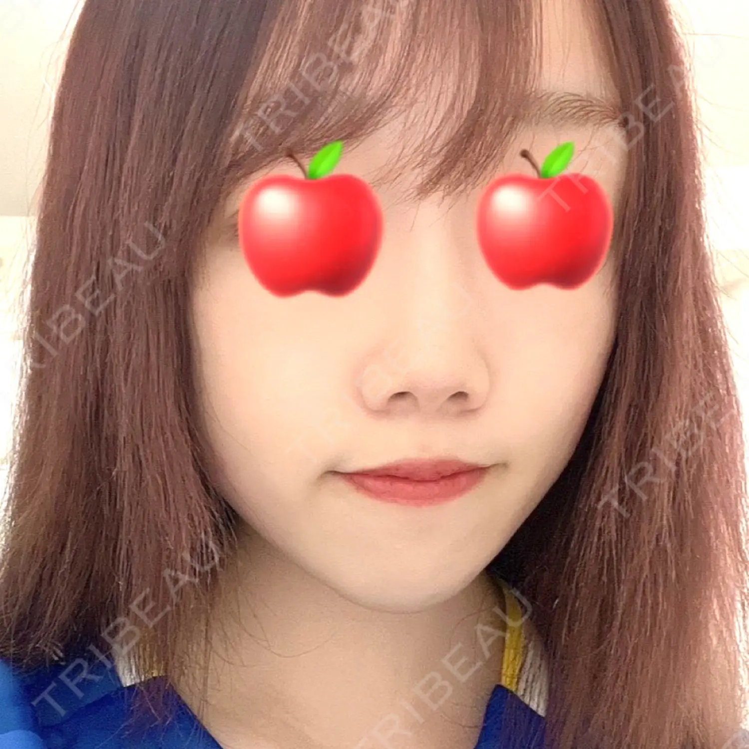 施術前の写真